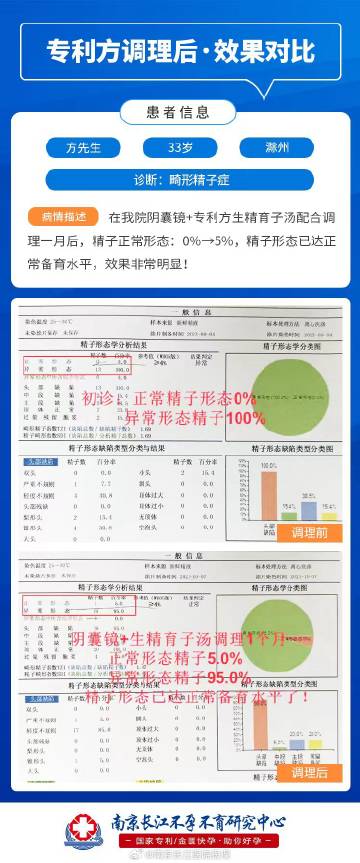 一个月未同房对精子质量的影响探究